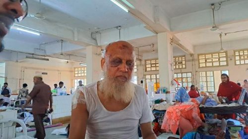 আহতদের অধিকাংশই কানে শুনছেন না