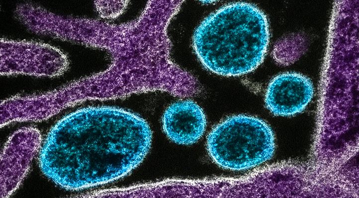 নওগাঁয় নিপাহ ভাইরাসে আক্রান্ত হয়ে গৃহবধূর মৃত্যু